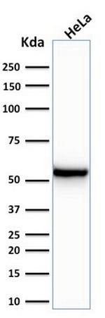 Cytokeratin 7 (Glandular and Transitional Epithelial Marker) Antibody in Western Blot (WB)