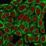 Cytokeratin 7 (Glandular and Transitional Epithelial Marker) Antibody in Immunocytochemistry (ICC/IF)