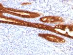 Cytokeratin 7 (Glandular and Transitional Epithelial Marker) Antibody in Immunohistochemistry (Paraffin) (IHC (P))