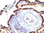 Cytokeratin 7 (Glandular and Transitional Epithelial Marker) Antibody in Immunohistochemistry (Paraffin) (IHC (P))