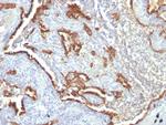 Cytokeratin 7 (Glandular and Transitional Epithelial Marker) Antibody in Immunohistochemistry (Paraffin) (IHC (P))