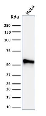 Cytokeratin 7 (Glandular and Transitional Epithelial Marker) Antibody in Western Blot (WB)