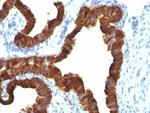 Cytokeratin 7 (Glandular and Transitional Epithelial Marker) Antibody in Immunohistochemistry (Paraffin) (IHC (P))