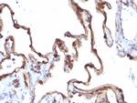 Cytokeratin 7 (Glandular and Transitional Epithelial Marker) Antibody in Immunohistochemistry (Paraffin) (IHC (P))