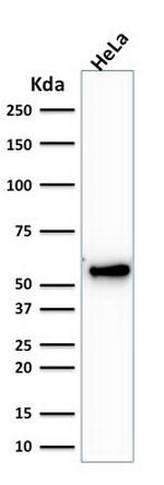 Cytokeratin 7 (Glandular and Transitional Epithelial Marker) Antibody in Western Blot (WB)