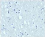 Cytokeratin 7 (Glandular and Transitional Epithelial Marker) Antibody in Immunohistochemistry (Paraffin) (IHC (P))