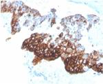 Cytokeratin 7 (Glandular and Transitional Epithelial Marker) Antibody in Immunohistochemistry (Paraffin) (IHC (P))