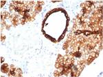 Cytokeratin 7 (Glandular and Transitional Epithelial Marker) Antibody in Immunohistochemistry (Paraffin) (IHC (P))