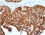 Cytokeratin 7 (Glandular and Transitional Epithelial Marker) Antibody in Immunohistochemistry (Paraffin) (IHC (P))