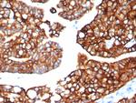 Cytokeratin 7 (Glandular and Transitional Epithelial Marker) Antibody in Immunohistochemistry (Paraffin) (IHC (P))