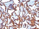 Cytokeratin 7 (Glandular and Transitional Epithelial Marker) Antibody in Immunohistochemistry (Paraffin) (IHC (P))