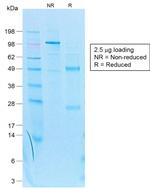 Cytokeratin 7 (Glandular and Transitional Epithelial Marker) Antibody in SDS-PAGE (SDS-PAGE)