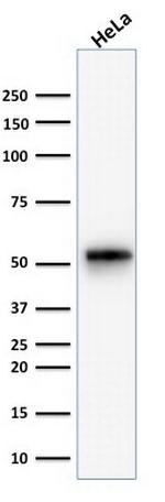 Cytokeratin 7 (Glandular and Transitional Epithelial Marker) Antibody in Western Blot (WB)