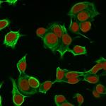 Cytokeratin 8 (KRT8) Antibody in Immunocytochemistry (ICC/IF)