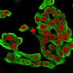 Cytokeratin 8 (KRT8) Antibody in Immunocytochemistry (ICC/IF)