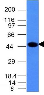 Cytokeratin 8 (KRT8) Antibody in Western Blot (WB)