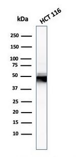 Cytokeratin 8 (KRT8) Antibody in Western Blot (WB)