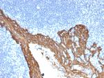 Cytokeratin 8 (KRT8) Antibody in Immunohistochemistry (Paraffin) (IHC (P))