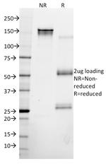 Cytokeratin 8 (KRT8) Antibody in SDS-PAGE (SDS-PAGE)