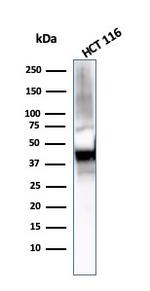 Cytokeratin 8 (KRT8) Antibody in Western Blot (WB)