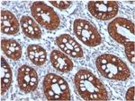 Cytokeratin 8 (KRT8) Antibody in Immunohistochemistry (Paraffin) (IHC (P))