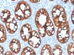 Cytokeratin 8 (KRT8) Antibody in Immunohistochemistry (Paraffin) (IHC (P))