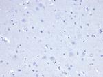 Cytokeratin 8 (KRT8) Antibody in Immunohistochemistry (Paraffin) (IHC (P))