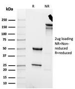 Cytokeratin 8 (KRT8) Antibody in SDS-PAGE (SDS-PAGE)