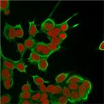 Cytokeratin 8 (KRT8) Antibody in Immunocytochemistry (ICC/IF)