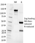 Cytokeratin 8 (KRT8) Antibody in SDS-PAGE (SDS-PAGE)