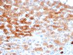 Cytokeratin 8 (KRT8) Antibody in Immunohistochemistry (Paraffin) (IHC (P))