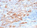 Cytokeratin 8 (KRT8) Antibody in Immunohistochemistry (Paraffin) (IHC (P))