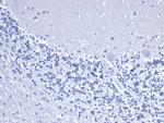 Cytokeratin 8 (KRT8) Antibody in Immunohistochemistry (Paraffin) (IHC (P))