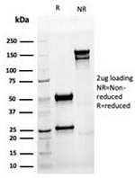 Cytokeratin 8 (KRT8) Antibody in SDS-PAGE (SDS-PAGE)