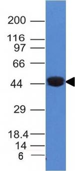 Cytokeratin 8 (KRT8) Antibody in Western Blot (WB)