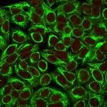 Cytokeratin 8 (KRT8) Antibody in Immunocytochemistry (ICC/IF)