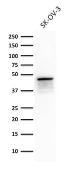 Cytokeratin 8 (KRT8) Antibody in Western Blot (WB)