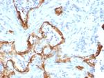 Cytokeratin 8 (KRT8) Antibody in Immunohistochemistry (Paraffin) (IHC (P))