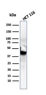 Cytokeratin 8 (KRT8) Antibody in Western Blot (WB)