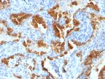 Cytokeratin 8 (KRT8) Antibody in Immunohistochemistry (Paraffin) (IHC (P))