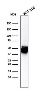 Cytokeratin 8 (KRT8) Antibody in Western Blot (WB)