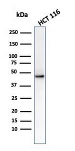 Cytokeratin 8 (KRT8) Antibody in Western Blot (WB)