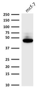 Cytokeratin 8 (KRT8) Antibody in Western Blot (WB)