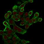 Cytokeratin 8 (KRT8) Antibody in Immunocytochemistry (ICC/IF)