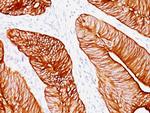 Cytokeratin 8 (KRT8) Antibody in Immunohistochemistry (Paraffin) (IHC (P))