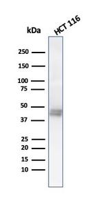 Cytokeratin 8 (KRT8) Antibody in Western Blot (WB)