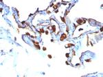 Cytokeratin 8 (KRT8) Antibody in Immunohistochemistry (Paraffin) (IHC (P))