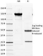 Cytokeratin 8 (KRT8) Antibody in SDS-PAGE (SDS-PAGE)