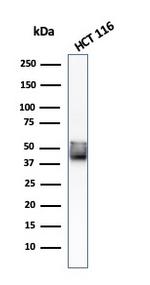 Cytokeratin 8 (KRT8) Antibody in Western Blot (WB)