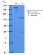 Cytokeratin 8 (KRT8) Antibody in SDS-PAGE (SDS-PAGE)